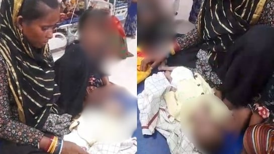 കണ്ണുകൾ കുഴിഞ്ഞ, മെലിഞ്ഞ ശരീരം;പോഷകാഹാരക്കുറവ്,  മധ്യപ്രദേശിൽ നാല് മാസം പ്രായമായ കുഞ്ഞ് മരിച്ചു