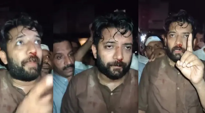 സ്വർണക്കൊള്ളയിൽ നിന്ന് ശ്രദ്ധ തിരിക്കാൻ ഷാഫി പറമ്പിലിനെ ആക്രമിച്ചെന്ന് കോൺഗ്രസ്; സംസ്ഥാനവ്യാപകമായി പ്രതിഷേധത്തിന് ആഹ്വാനം