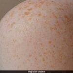 പൊതുജനങ്ങൾക്ക് ജാഗ്രതാ നിർദ്ദേശം, അഞ്ചാം പനി ബാധിച്ച യാത്രക്കാരൻ ന്യൂവാർക്ക് വിമാനത്താവളത്തിൽ എത്തി; വൈറസ് പടരാനുള്ള സാധ്യത