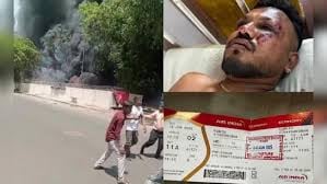 ‘ശാരീരികമായും മാനസികമായും തകർന്നു, ജീവിതം ദുരിതം’, അഹമ്മദാബാദ് എയർ ഇന്ത്യ വിമാനാപകടത്തിൽ നിന്നും രക്ഷപ്പെട്ട ‘ലക്കി മാൻ’ പറയുന്നു