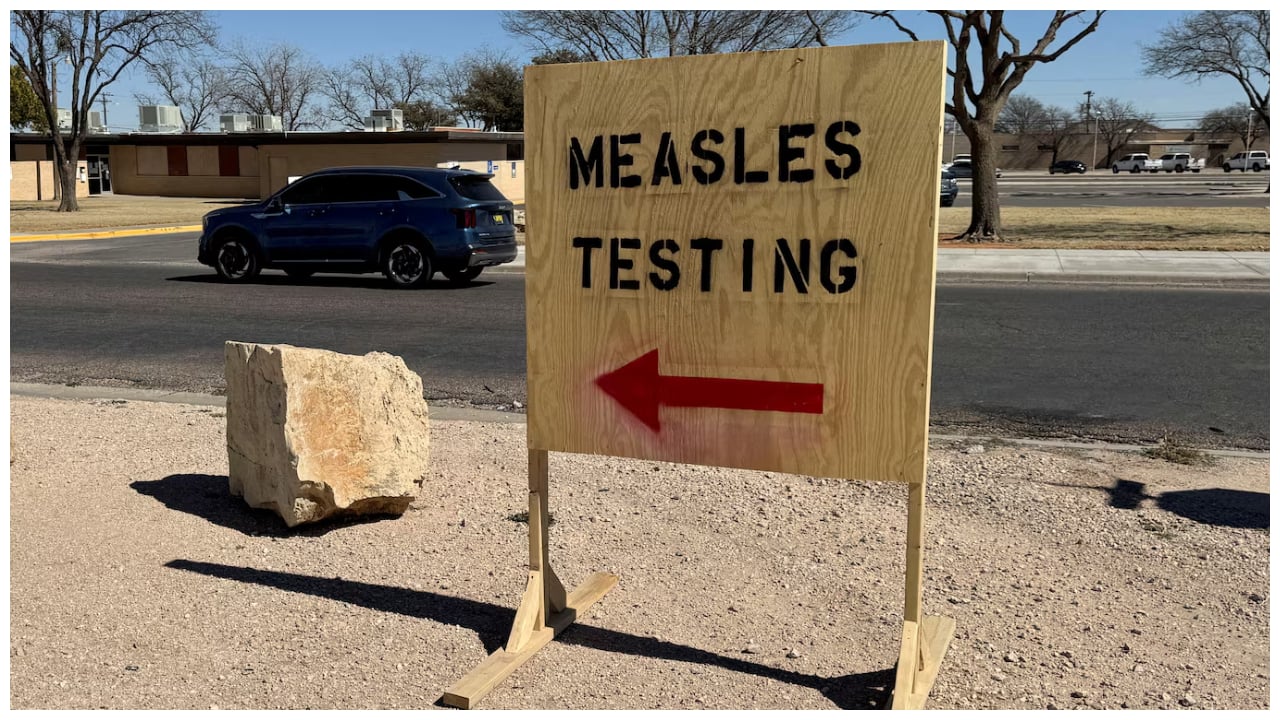 അമേരിക്കയിൽ അഞ്ചാംപനി ജാഗ്രത; സൗത്ത് കരോലിനയിൽ രൂക്ഷം, മേഖലയിൽ നാല് ദിവസത്തിനിടെ നൂറോളം പേർക്ക് രോഗബാധ