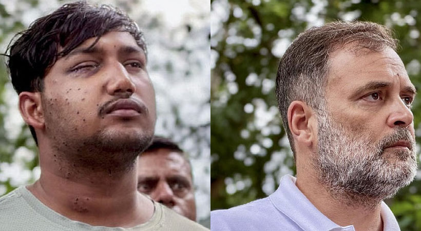 രാഹുല്‍ ഗാന്ധിയുടെ സമരം ഫലം കണ്ടു; പെല്ലറ്റ് ആക്രമണത്തില്‍ പരുക്കേറ്റ വിദ്യാര്‍ഥിയുടെ മൊഴിയെടുക്കും